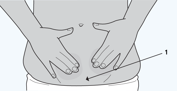 CS-Teleabortion-pubic-bone-illustration Public bone location