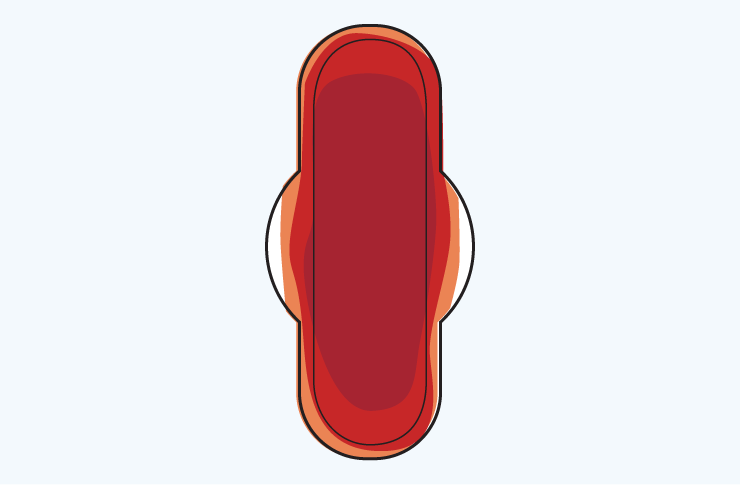 haemorrhage-illustration Haemorrhage illustration