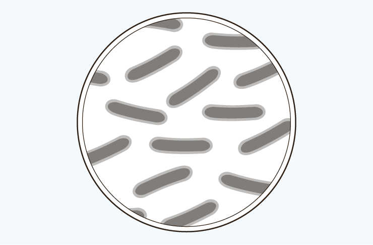 infection-illustration Infection illustration